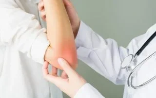 Protibolečinska terapija