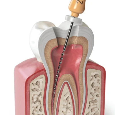 Endodontija
